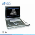 AG-BU009 CE ISO Full-digital laptop portable ultrasound scanner
 